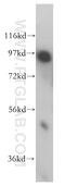 ADAM Metallopeptidase Domain 12 antibody, 14139-1-AP, Proteintech Group, Western Blot image 
