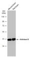 Aldolase, Fructose-Bisphosphate B antibody, GTX101363, GeneTex, Western Blot image 