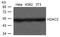 Histone Deacetylase 3 antibody, 79-759, ProSci, Western Blot image 
