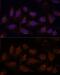 Protein Phosphatase 2 Catalytic Subunit Beta antibody, GTX33421, GeneTex, Immunocytochemistry image 