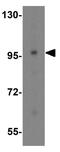 Transportin 3 antibody, GTX31343, GeneTex, Western Blot image 