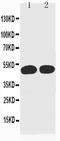Cyclin A2 antibody, MA1032, Boster Biological Technology, Western Blot image 