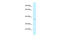 AlkB Homolog 1, Histone H2A Dioxygenase antibody, AP46320PU-N, Origene, Western Blot image 