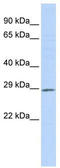 Proteasome Assembly Chaperone 1 antibody, TA338920, Origene, Western Blot image 