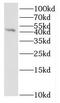 Interleukin 36 Beta antibody, FNab04240, FineTest, Western Blot image 