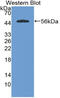 Cystatin SA antibody, abx131847, Abbexa, Western Blot image 