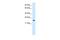 MYCL Proto-Oncogene, BHLH Transcription Factor antibody, A07853, Boster Biological Technology, Western Blot image 