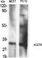 Acyl-CoA Thioesterase 8 antibody, STJ91454, St John