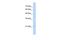 Guanosine Monophosphate Reductase 2 antibody, GTX46239, GeneTex, Western Blot image 