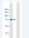 Transglutaminase 7 antibody, H00116179-B01P-50ug, Novus Biologicals, Western Blot image 