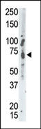 Protein Tyrosine Phosphatase Non-Receptor Type 9 antibody, AP15213PU-N, Origene, Western Blot image 