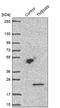 Transmembrane Protein 69 antibody, PA5-55477, Invitrogen Antibodies, Western Blot image 