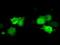 Cilia And Flagella Associated Protein 298 antibody, NBP2-02702, Novus Biologicals, Immunocytochemistry image 