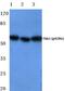 Checkpoint Kinase 1 antibody, PA5-36795, Invitrogen Antibodies, Western Blot image 