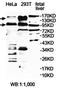 Ubiquitin Specific Peptidase 33 antibody, orb78280, Biorbyt, Western Blot image 