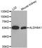 Aldehyde Dehydrogenase 8 Family Member A1 antibody, LS-C332596, Lifespan Biosciences, Western Blot image 
