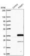 Proteasome Inhibitor Subunit 1 antibody, NBP1-80910, Novus Biologicals, Western Blot image 