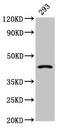 Hydroxysteroid 11-Beta Dehydrogenase 2 antibody, CSB-PA010765LA01HU, Cusabio, Western Blot image 