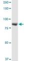 Leucine Rich Repeat And Sterile Alpha Motif Containing 1 antibody, H00090678-D01, Novus Biologicals, Western Blot image 