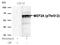 Myocyte Enhancer Factor 2A antibody, GTX50114, GeneTex, Western Blot image 