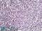 Interferon-inducible protein AIM2 antibody, 42-531, ProSci, Immunohistochemistry paraffin image 