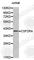 Colony Stimulating Factor 2 Receptor Alpha Subunit antibody, A3167, ABclonal Technology, Western Blot image 