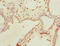 Thyroid Hormone Responsive antibody, LS-C676590, Lifespan Biosciences, Immunohistochemistry paraffin image 