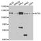 Integrator Complex Subunit 6 antibody, A6634, ABclonal Technology, Western Blot image 