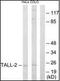 TNF Superfamily Member 13 antibody, orb96030, Biorbyt, Western Blot image 