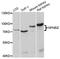 NFKB Inhibitor Zeta antibody, A10492, ABclonal Technology, Western Blot image 