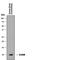 S100 Calcium Binding Protein B antibody, MAB1820, R&D Systems, Western Blot image 