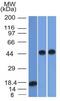 Alpha-1-antitrypsin antibody, GTX34403, GeneTex, Western Blot image 