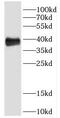 Trans-1,2-dihydrobenzene-1,2-diol dehydrogenase antibody, FNab02364, FineTest, Western Blot image 
