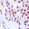 Zinc Finger Protein, FOG Family Member 2 antibody, orb339168, Biorbyt, Immunohistochemistry paraffin image 