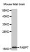 Fatty Acid Binding Protein 7 antibody, abx002070, Abbexa, Western Blot image 