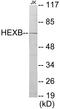 Hexosaminidase Subunit Beta antibody, EKC1671, Boster Biological Technology, Western Blot image 