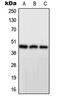 Protein Phosphatase 1 Regulatory Subunit 7 antibody, MBS820425, MyBioSource, Western Blot image 