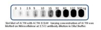 Proopiomelanocortin antibody, ACTH-FITC, FabGennix, Western Blot image 