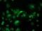 Aspartoacylase-2 antibody, MA5-25391, Invitrogen Antibodies, Immunocytochemistry image 