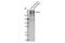 Sodium Voltage-Gated Channel Alpha Subunit 5 antibody, 14421S, Cell Signaling Technology, Western Blot image 