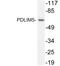 PDZ And LIM Domain 5 antibody, LS-C199963, Lifespan Biosciences, Western Blot image 