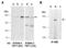 Tet Methylcytosine Dioxygenase 1 antibody, R1084-4, Abiocode, Western Blot image 