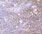 Spectrin Alpha, Non-Erythrocytic 1 antibody, A03831-2, Boster Biological Technology, Immunohistochemistry paraffin image 