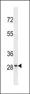 Family With Sequence Similarity 110 Member D antibody, PA5-49257, Invitrogen Antibodies, Western Blot image 