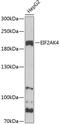 Eukaryotic Translation Initiation Factor 2 Alpha Kinase 4 antibody, GTX57741, GeneTex, Western Blot image 