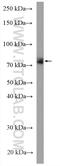 EF-Hand Domain Containing 1 antibody, 11471-1-AP, Proteintech Group, Western Blot image 