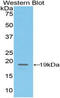 Adhesion G Protein-Coupled Receptor E5 antibody, LS-C293376, Lifespan Biosciences, Western Blot image 