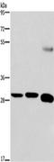 Fibroblast Growth Factor 8 antibody, TA322119, Origene, Western Blot image 