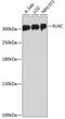 Filamin C antibody, GTX66151, GeneTex, Western Blot image 