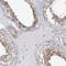 Mitogen-Activated Protein Kinase Kinase Kinase Kinase 5 antibody, NBP1-83385, Novus Biologicals, Immunohistochemistry frozen image 